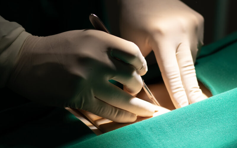 Mãos de estudante de Medicina da Unoeste com luvas realizando simulação de procedimento cirúrgico em um manequim, manipulando instrumentos em campo estéril iluminado.