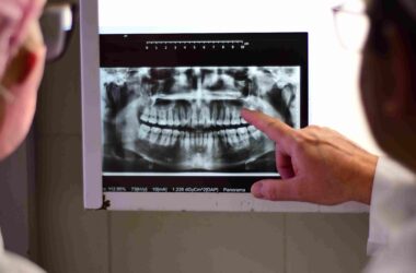 Professor e estudantes de Odontologia da Unoeste analisam radiografia panorâmica dos dentes durante aula prática em clínica odontológica da universidade.