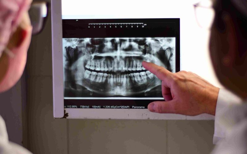 Professor e estudantes de Odontologia da Unoeste analisam radiografia panorâmica dos dentes durante aula prática em clínica odontológica da universidade.