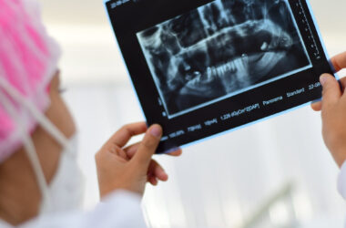 Estudante de Odontologia da Unoeste com touca cirúrgica e jaleco branco analisando uma radiografia panorâmica odontológica, observando a estrutura óssea e a posição dos dentes. Imagem representa a atuação clínica do periodontista no diagnóstico de doenças periodontais.