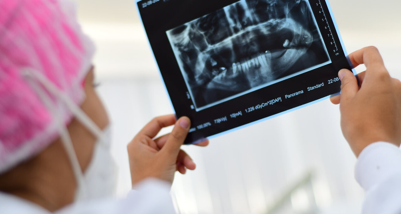 Estudante de Odontologia da Unoeste com touca cirúrgica e jaleco branco analisando uma radiografia panorâmica odontológica, observando a estrutura óssea e a posição dos dentes. Imagem representa a atuação clínica do periodontista no diagnóstico de doenças periodontais.
