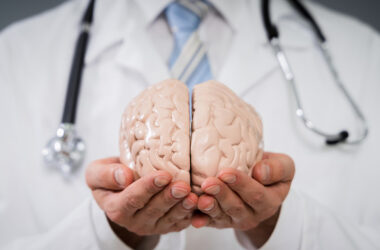 Médico segurando um modelo anatômico de cérebro humano, simbolizando cuidados neurológicos e prevenção de AVC