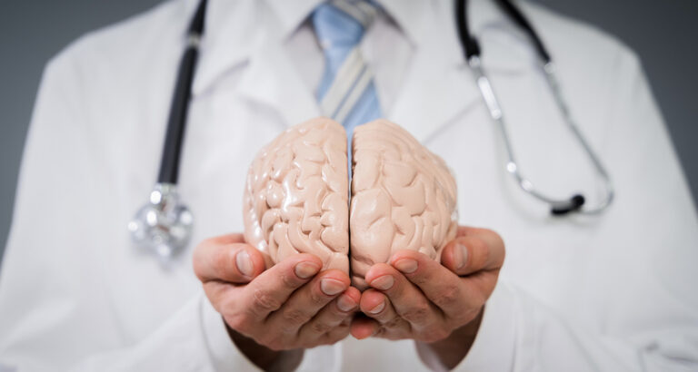 Médico segurando um modelo anatômico de cérebro humano, simbolizando cuidados neurológicos e prevenção de AVC