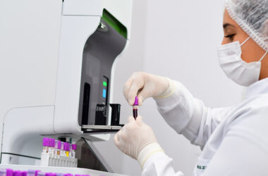 Profissional da saúde usando luvas, segurando tubo com amostra de sangue em ambiente de laboratório.