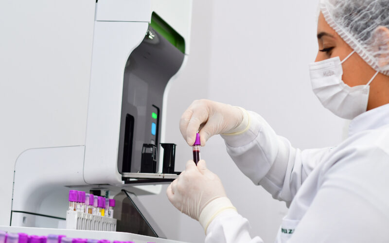 Profissional da saúde usando luvas, segurando tubo com amostra de sangue em ambiente de laboratório.