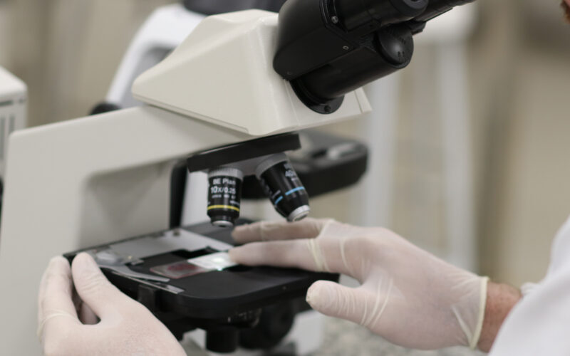 Pessoa utilizando microscópio em laboratório, com luvas, analisando lâmina com amostra para exame de citologia.