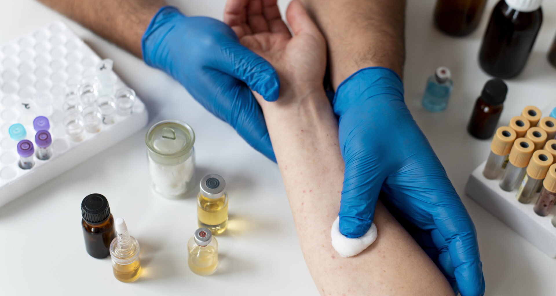 Profissional da saúde realiza avaliação de reação alérgica no antebraço de um paciente durante atendimento em Alergia e Imunologia, com materiais para testes alérgicos e amostras laboratoriais sobre a bancada.