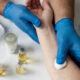 Profissional da saúde realiza avaliação de reação alérgica no antebraço de um paciente durante atendimento em Alergia e Imunologia, com materiais para testes alérgicos e amostras laboratoriais sobre a bancada.